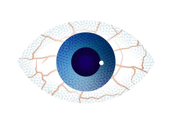 drawn image of a red, dry eye